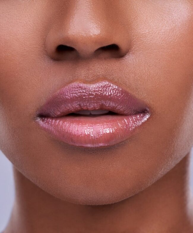 Lip Fillers - Rejuvenation Clinic - Vienna Med Spa
