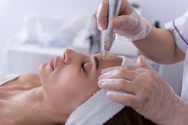 FAQ: Morpheus8 Microneedling - Blog - Rejuvenation Clinic - Vienna Med Spa