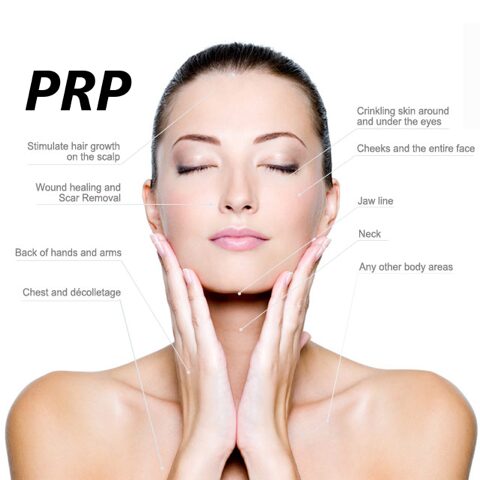 PRP treatment diagram