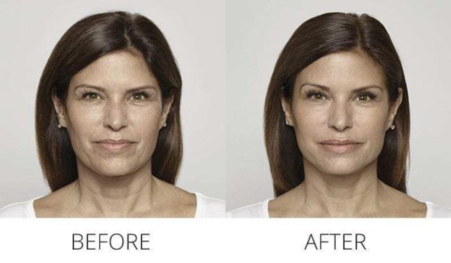 Skin Care - Rejuvenation Clinic - Vienna Med Spa