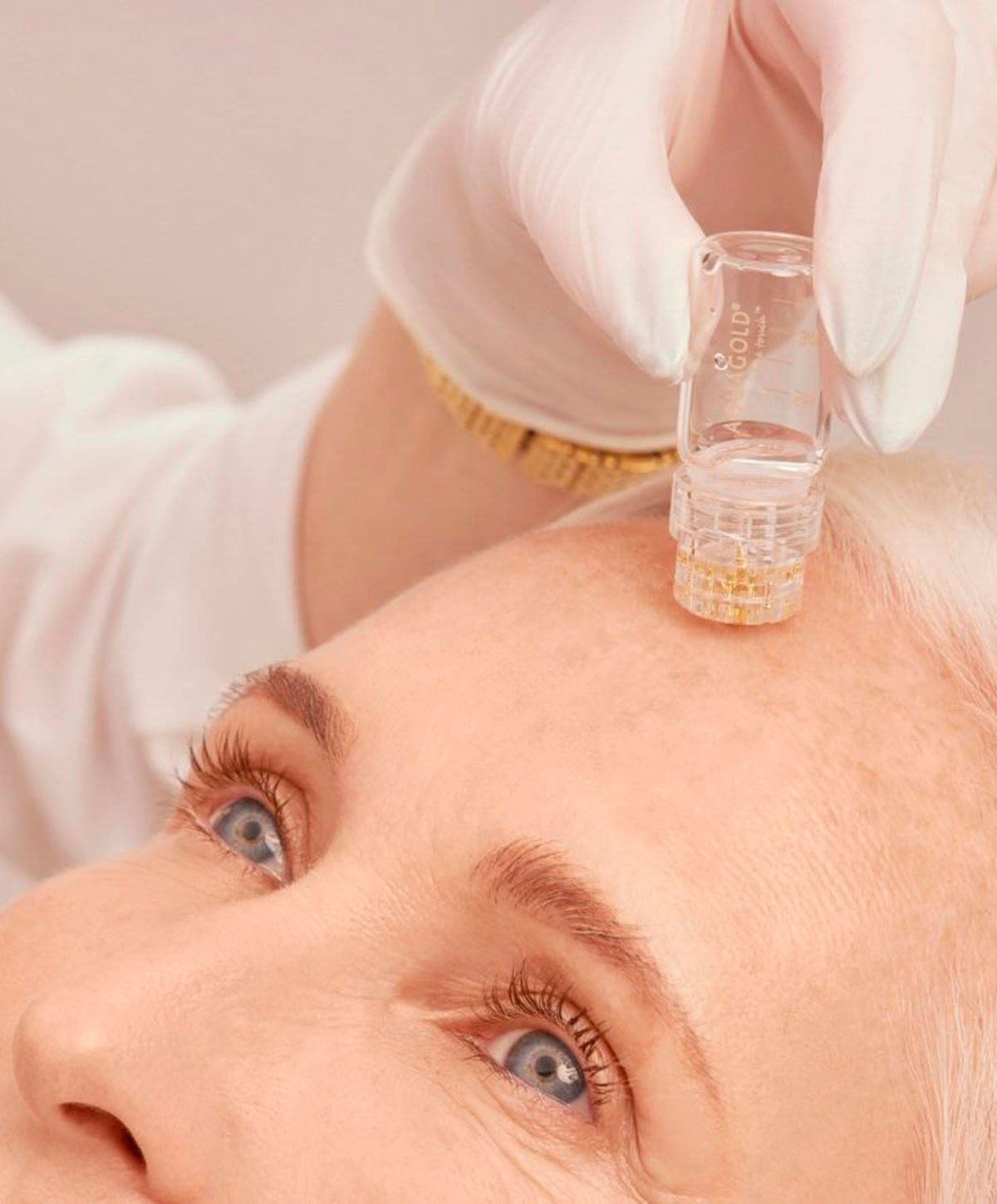 Aquagold Microneedling - Rejuvenation Clinic - Vienna Med Spa