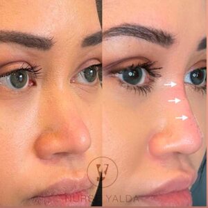Non-surgical - Rejuvenation Clinic