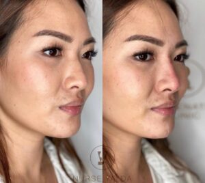 Non-surgical - Rejuvenation Clinic