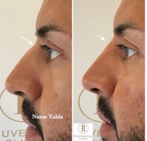 Non-surgical - Rejuvenation Clinic