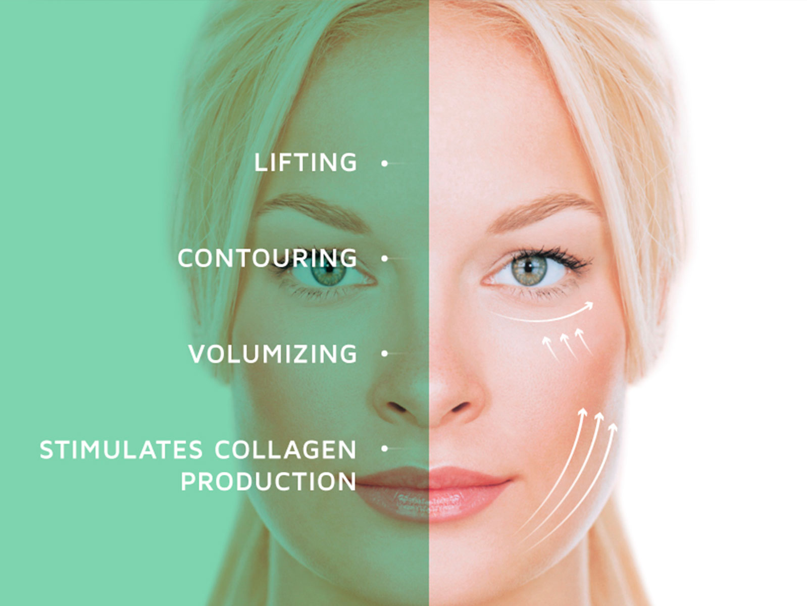 PDO Thread Lift - Rejuvenation Clinic - Vienna Med Spa