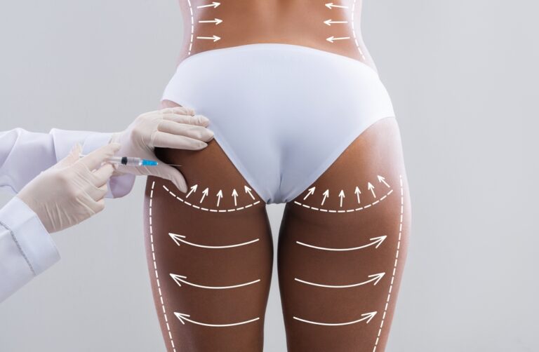 Butt Enhancement Buttock | Rejuvenation Clinic