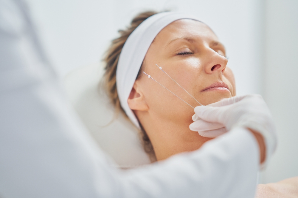 Why You Should Book a PDO Thread Lift and Collagen Lift Appointment in McLean, VA