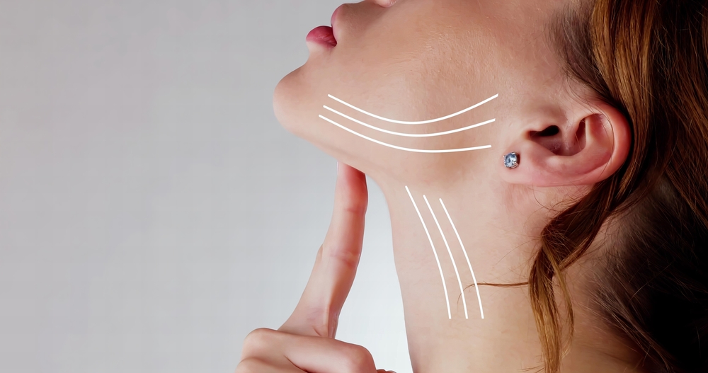 What Are the Benefits of RF Microneedling Skin Tightening and Collagen Remodeling in Arlington, VA?