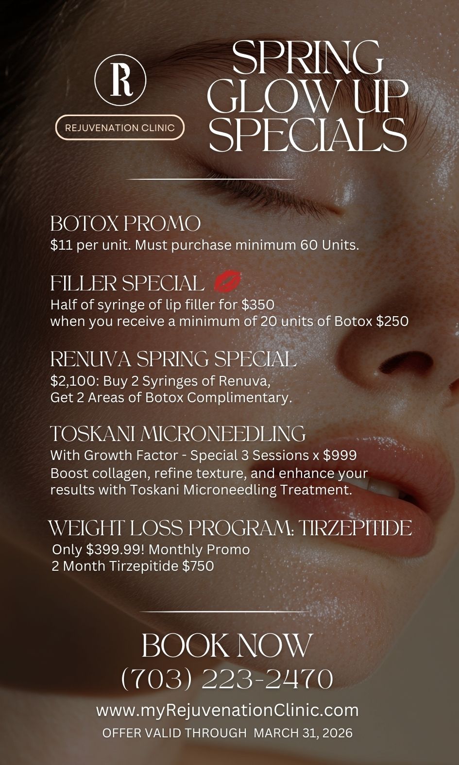 Exclusive Offer — March 2026 - Limited Time Only