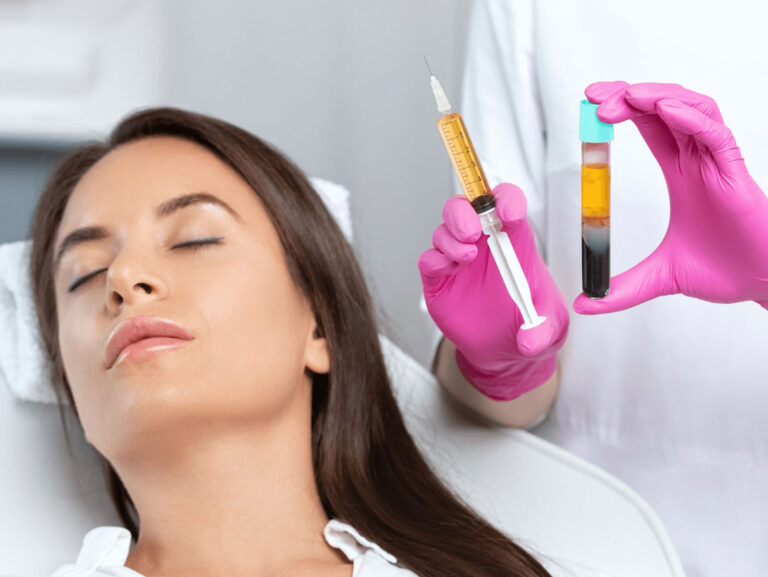 PRP Skin Rejuvenation - Rejuvenation Clinic - Vienna Med Spa